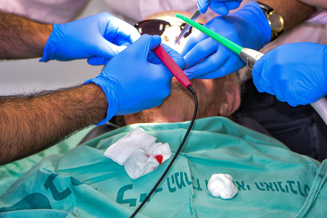 Chirurgia stomatologiczna – kiedy jest konieczna i czego się spodziewać?