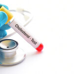 Test tube with blood sample for cholesterol test