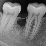 chatgptimage18lis202512_16_28